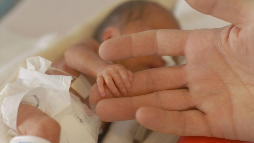 Some of World's Tiniest ‘Preemies’ Are Growing Up Healthy